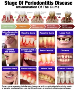 𝐍𝐚𝐭𝐫𝐚𝐯𝐨𝐫® VioCore Bee Venom Gingivitis & Periodontitis Treatment Toothpaste