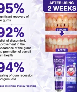 𝐍𝐚𝐭𝐫𝐚𝐯𝐨𝐫® VioCore Bee Venom Gingivitis & Periodontitis Treatment Toothpaste
