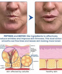 Natravor® PDRN Anti-Wrinkle Cream