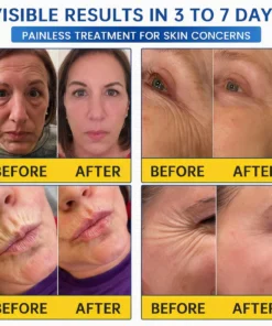 Natravor® PDRN Anti-Wrinkle Cream