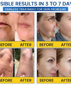 Natravor® PDRN Anti-Wrinkle Cream