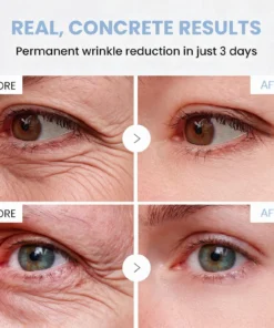 Natravor® PDRN Anti-Wrinkle Cream
