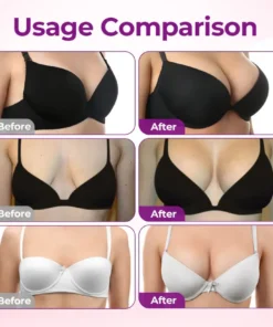 Natravor® Targeted Breast Enhancement Advanced Nano Microneedle Patch